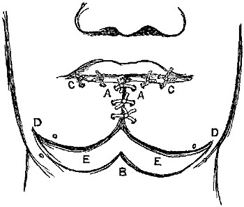 Fig. xxii.