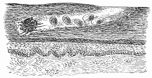 57. Sarcoptes scabiei. Diagrammatic representation of the course in
the skin of man.